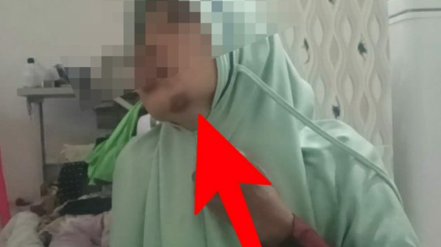 Dianiaya Tetangga Sendiri, Seorang Perempuan di Kecamatan Batuputih Lapor Polisi