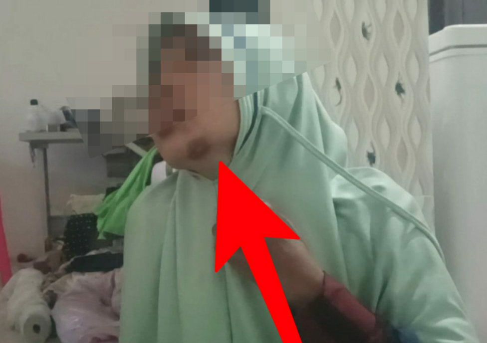 Dianiaya Tetangga Sendiri, Seorang Perempuan di Kecamatan Batuputih Lapor Polisi